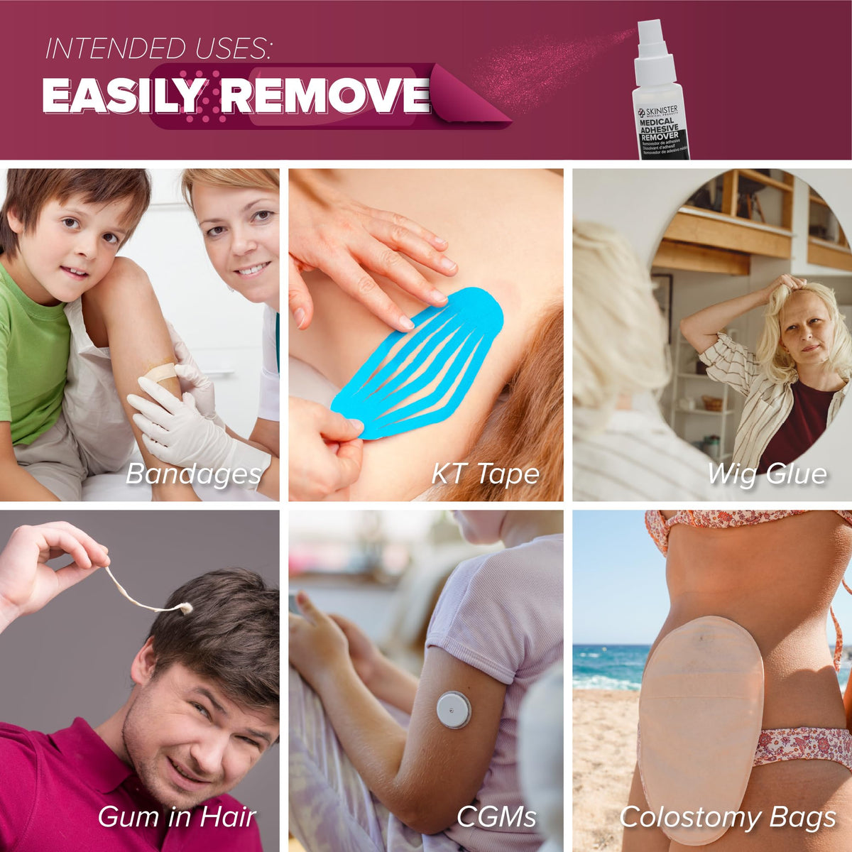 Adhesive Remover Wipes 50 Dry Wipes + 2oz Spray Solution A164